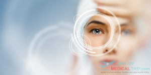 SICS - Small Incision Cataract Surgery