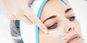 Brow and Forehead Lift - Botox