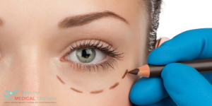 Eyelid Correction Surgery 